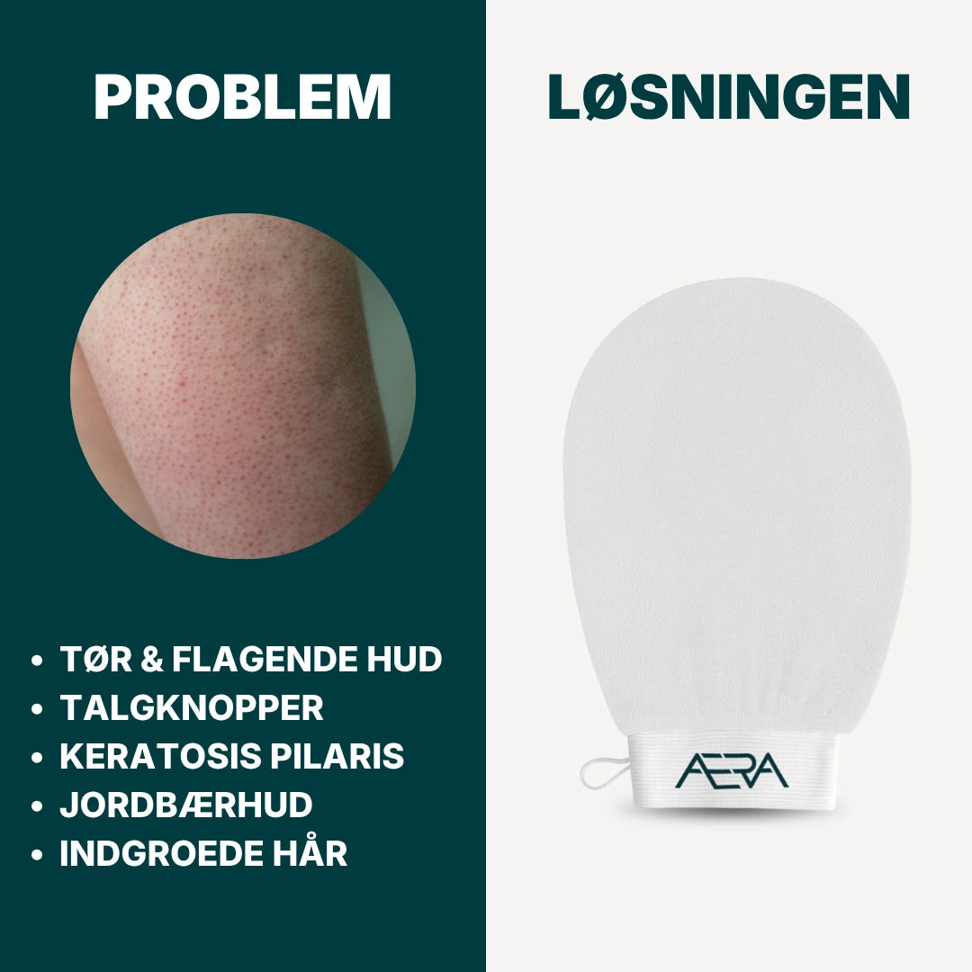 Eksfolieringshandske